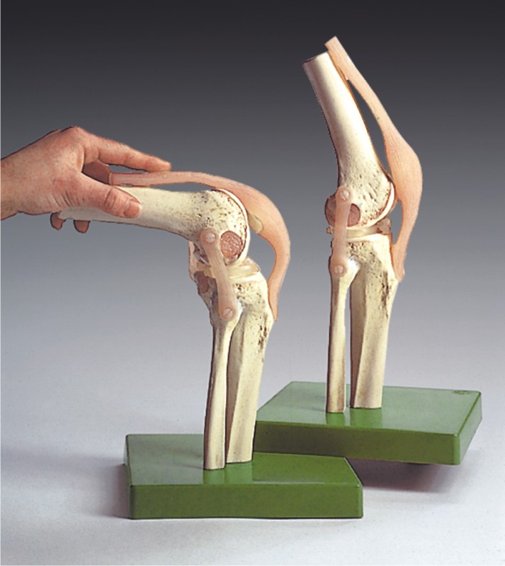 Functional Model of the Knee Joint - MedWest Medical Supplies